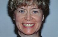 Ellen Before Porcelain Bonding