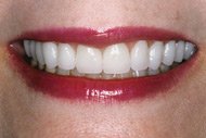 Carol's smile after